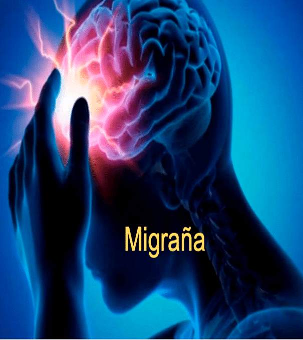 imagen ilustrativa de persona agarrandose la cabeza por un dolor de causado por una migraña